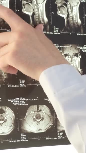 Vertebrólogo Examina Una Imagen Rayos Una Paciente Femenina Hospital Concepto — Vídeos de Stock