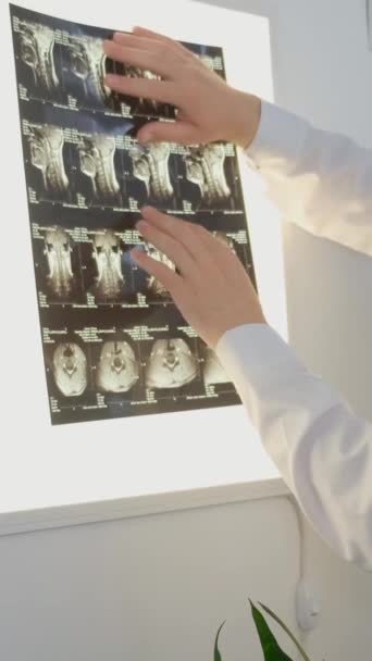Zkušený Lékař Hodnotí Anatomii Páteře Mladých Dívek Doktor Podívá Rentgen — Stock video