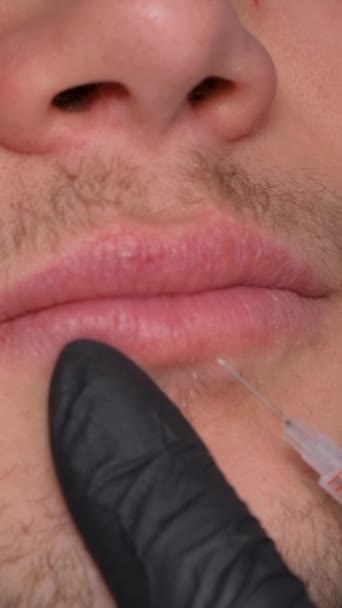 美容师给一个人注射以增加嘴唇 男性化妆品学 垂直录像 — 图库视频影像