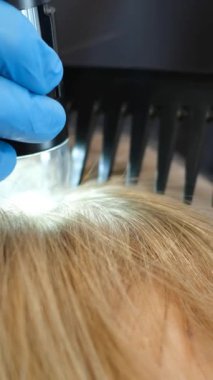 Bir trikoloğun muayenesi sırasında hastaların kafalarına yakın çekim. Bir doktor bir kadının kafasını fener ve tarakla muayene eder. Dikey video