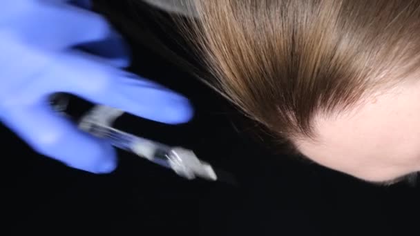 一位戴医用手套的医生给一位妇女注射了脱发针剂 头皮疾病的治疗 垂直录像 — 图库视频影像