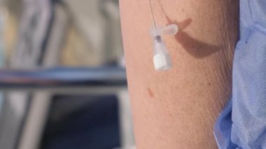 Doktor damara bir iğne yerleştiriyor ve bir damla ekliyor. Kapatın. Dikey video