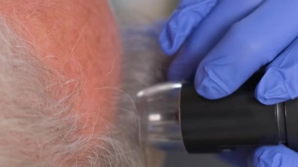 트리코로지스트는 노인의 자세한 머리카락 검사를 실시합니다 대머리와 비디오 — 비디오