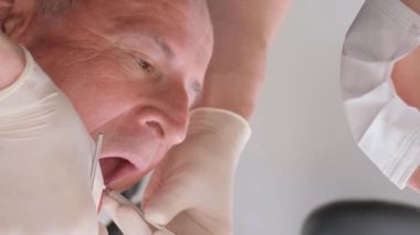 Üniformalı profesyonel bir diş cerrahı, modern aletlerle klinikteki yaşlı bir hastaya diş implantı takmak için ameliyat yapar. 4Dikey Video
