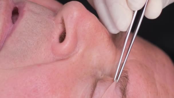 閉じる 目の領域を変更するための手術前に老人の顔の検査 バーティカルビデオ — ストック動画