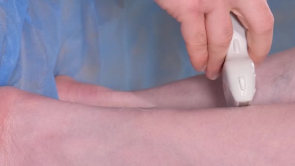 Medic Echipament Diagnosticare Efectuează Examinare Ultrasunete Venelor Picioarelor Pacienților — Videoclip de stoc