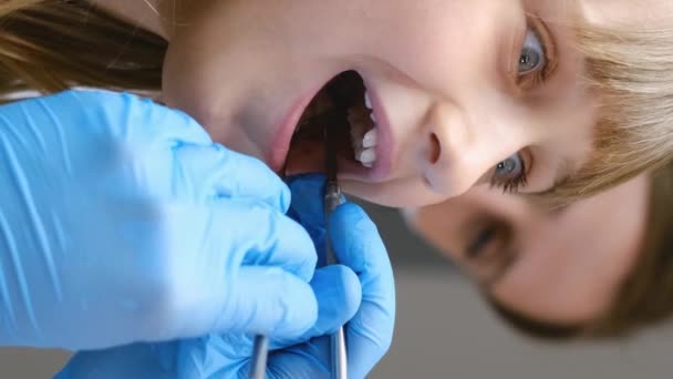 Piękna Dziewczynka Dentysty Badanie Stomatologiczne Próchnica Leczenie Stomatologiczne Dzieci Pionowe — Wideo stockowe