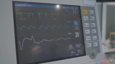 Nitelikli cerrahların gözetiminde, yaşlı bir kadın ameliyat masasında. Varisli damarların tedavisi için karmaşık bir prosedür uygulanır.