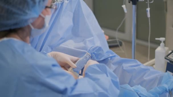숙련된 외과의사는 정맥류의 복잡한 절차를 수행합니다 클리닉에서 — 비디오