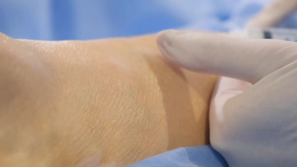 Έμπειροι Χειρουργοί Εκτελούν Μια Πολύπλοκη Διαδικασία Για Τους Κιρσούς Μια — Αρχείο Βίντεο
