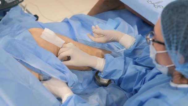 Wykwalifikowany Zespół Chirurgiczny Koncentruje Się Wykonywaniu Operacji Żylaków Celu Leczenia — Wideo stockowe