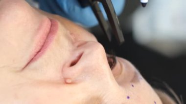 Estetik cerrahide yaşlı bir kadın, yaş kırışıklıklarını gidermek için danışmanlık yapıyor. Yüzünde kırışıklıklar, göz kapaklarının kenarları sarkmış. Yüzün üst üçte birinin düzeltilmesi. Dikey video