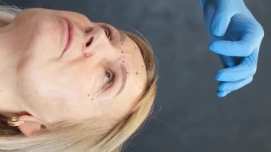 Estetik cerrahide yaşlı bir kadın, yaş kırışıklıklarını gidermek için danışmanlık yapıyor. Yüzünde kırışıklıklar, göz kapaklarının kenarları sarkmış. Yüzün üst üçte birinin düzeltilmesi. Dikey video