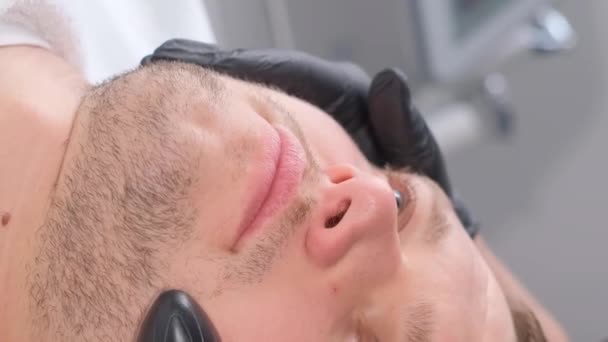 Yüz Temizleme Prosedürü Yüz Için Ultrasonik Cihazın Prosedürü Erkeklerde Sivilce — Stok video