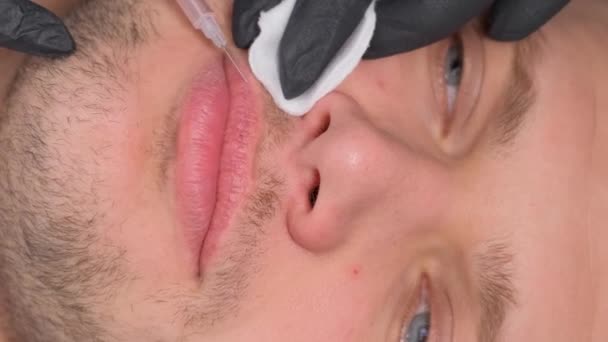 Cosmetologista Uma Pessoa Uma Injeção Para Aumentar Lábios Cosmetologia Masculina — Vídeo de Stock