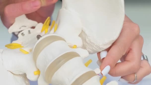 Doktor Masadaki Omurgada Omurgalar Arası Fıtık Olduğunu Gösteriyor Omurgada Sorun — Stok video