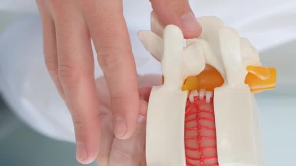 Doktor Masadaki Omurgada Omurgalar Arası Fıtık Olduğunu Gösteriyor Omurgada Sorun — Stok video
