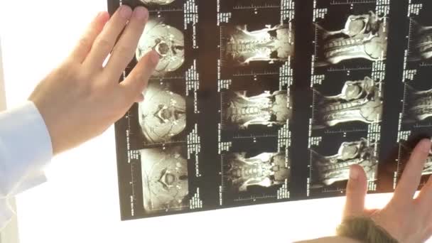 Хребтолог Вивчає Рентгенівське Зображення Хребта Жінок Лікарні Медицина Охорона Здоров — стокове відео