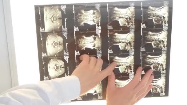 Egy Profi Csigolyológus Megvizsgálja Egy Női Beteg Gerincröntgenjét Egy Kórházban — Stock videók