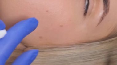 Tıbbi eldivenli bir cerrah kırışıklıkların görünmesini önlemek için yüz derisine iğne yapar. Dikey video