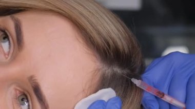 Bir tricholog güzel bir kızın kafasına iğne yapar. Sorunlu saçların tedavisi. Güzel saçlar. Dikey video