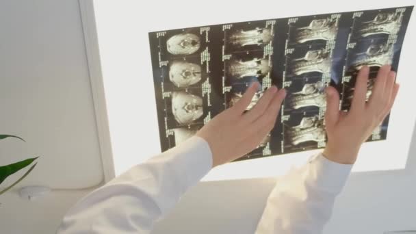 Doświadczony Lekarz Ocenia Anatomię Kręgosłupa Młodych Dziewcząt Lekarz Patrzy Rentgen — Wideo stockowe