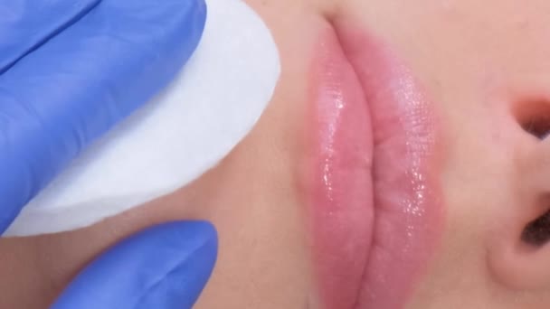 若い女性が唇にボトックス注射を受けます 美容室にいる女性 プラスチック手術のクリニック クローズアップ バーティカルビデオ — ストック動画