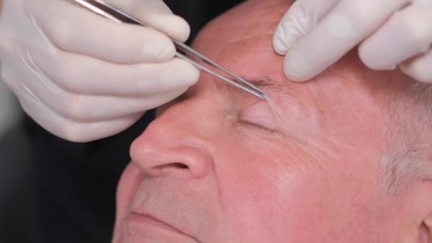 노인의 얼굴에 수술을위한 성형외과의사가 눈꺼풀의 피부를 핀셋으로 조여줍니다 — 비디오