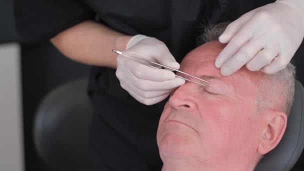 노인의 얼굴에 수술을위한 성형외과의사가 눈꺼풀의 피부를 핀셋으로 조여줍니다 — 비디오