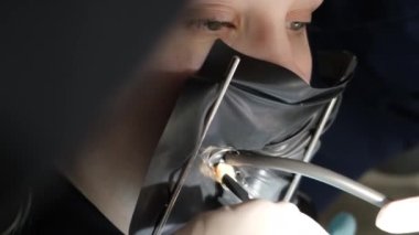Genç bir kadının dişlerini modern teknoloji ve aletlerle tedavi etme süreci. Diş sorunlarının tam zamanında ortadan kaldırılması. Dikey video