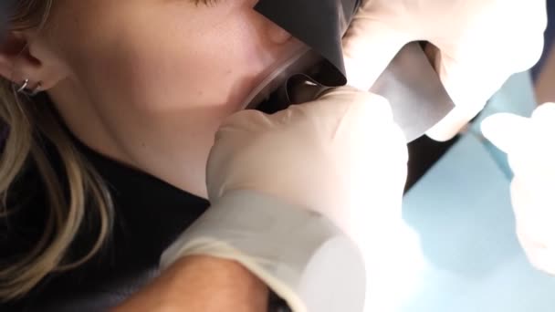 在治疗牙齿的过程中坐在牙椅上的病人 从上面看病人在治疗期间张开嘴 垂直录像 — 图库视频影像