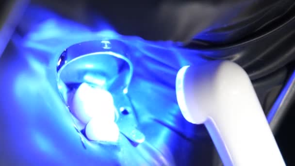 充填に紫外線を使用した歯科治療プロセスのクローズアップ 健康な歯の概念について 現代歯科技術について バーティカルビデオ — ストック動画