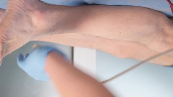 一位女医生用超声对病人的膝盖进行X光检查 老年患者腿的治疗 垂直录像 — 图库视频影像