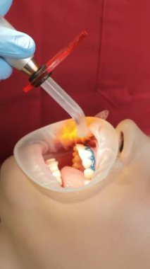Ultraviyole lambayla diş beyazlatma prosedürünü yakından çekeceğiz. Klinikteki dişçide kadın hasta. Dikey video