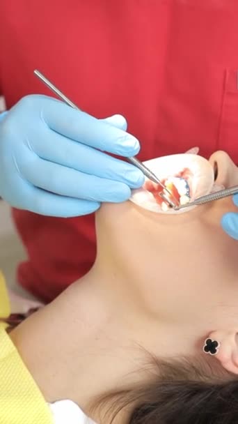 의사는 기기를 사용하여 환자의 치아를 검사합니다 비디오 — 비디오