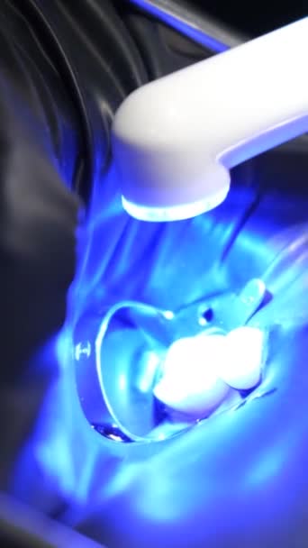 Крупный План Процесса Стоматологической Обработки Использованием Ультрафиолетового Света Заполнения Концепция — стоковое видео