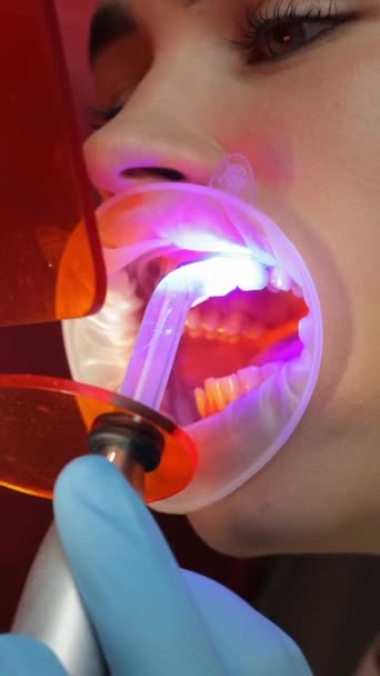Een Tandarts Voert Professionele Tandglazuur Bleken Orthodontist Verwijdert Resten Van — Stockvideo