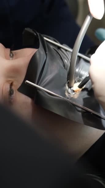 Proces Leczenia Zębów Młodej Kobiety Przy Użyciu Nowoczesnych Technologii Narzędzi — Wideo stockowe