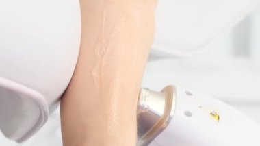 Epilasyon kozmetikçisi güzel kadın ellerindeki kılları lazerle alıyor. Ellerde saç kesimi, klinikte lazer prosedürü. Dikey video.