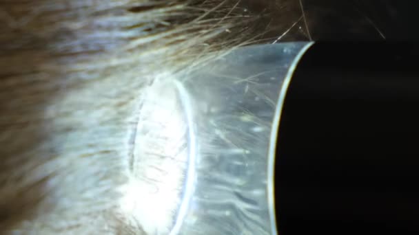 Trichoskopia Włosów Zbliżenie Skóry Głowy Trycholog Diagnozuje Stan Włosów Pionowe — Wideo stockowe