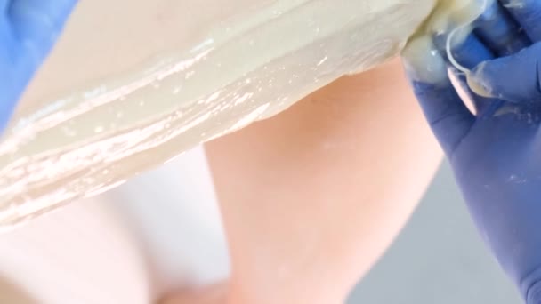 美容院里的女人腿上有脱毛程序和糖糊剂 美容师正在使用止痛膏 脱毛程序 垂直录像 — 图库视频影像