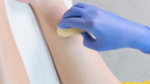 Zbliżenie Kosmetyczki Usuwa Włosy Nogach Żółtym Paskiem Woskowym Pionowe Wideo — Wideo stockowe