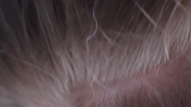 Zbliżenie Siwych Włosów Głowie Młodej Dziewczyny Początkowy Etap Siwych Włosów — Wideo stockowe