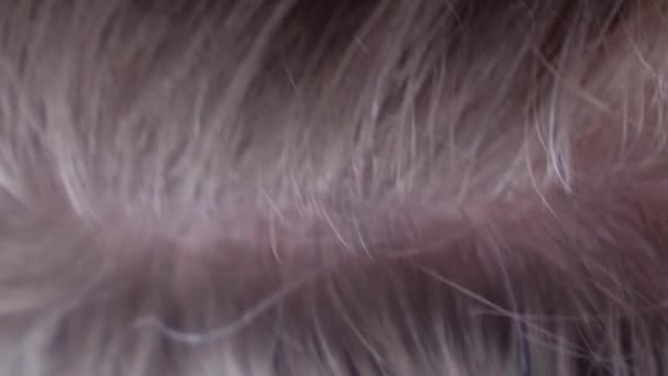 若い女性の頭の上の初期の灰色の髪のクローズアップ 灰色の髪の問題 バーティカルビデオ — ストック動画