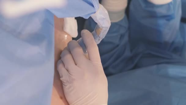 Processo Esecuzione Operazione Parte Gruppo Medici Professionisti Chirurgo Esegue Operazione — Video Stock