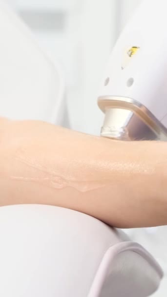 Epilation Cosmetologist Removes Hair Beautiful Female Hands Using Laser Hair — Stock Video