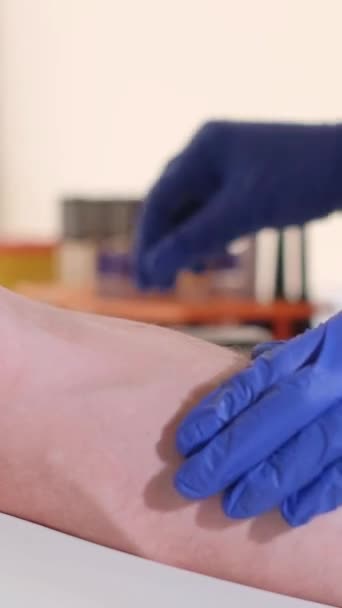 研究室の研究のために患者の静脈から血液を採取する 初期段階での疾患の診断 血液中の抗体の検出 バーティカルビデオ — ストック動画