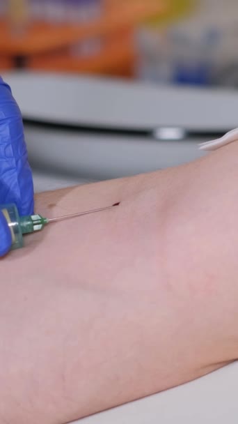 分析のために患者の腕の静脈から血液を採取する看護師のクローズアップ 診断を確立するために患者の血液の診断 バーティカルビデオ — ストック動画