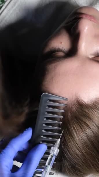 Профессиональный Косметолог Проводит Мезотерапию Головы Женщины Укрепления Волос Роста Вертикальное — стоковое видео