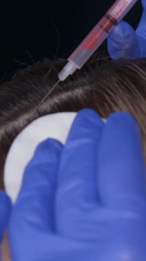 Hastanın kafasına yapılan kozmetik enjeksiyonun yakın çekimi. Saç dökülmesine karşı bir prosedür. Dikey video. 